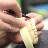 歯科技工物の制作
