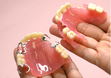 普通の入れ歯とスマイルデンチャー