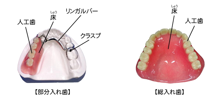 保険適用義歯（保険入れ歯）